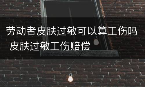 劳动者皮肤过敏可以算工伤吗 皮肤过敏工伤赔偿